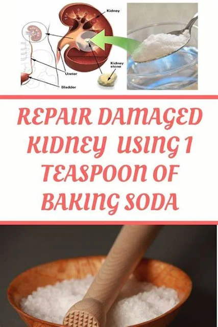 How To Repair Your Damaged Kidney Naturally Using 1 Teaspoon Of Baking Soda