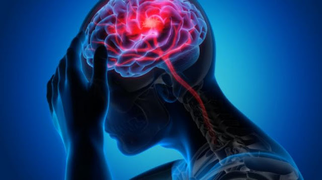 Ovo su alarmantni simptomi "tihog" moždanog udara