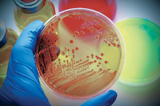 Isolation and Screening for Citric Acid Production by Aspergillus Niger Using Sucrose as a Carbon Source