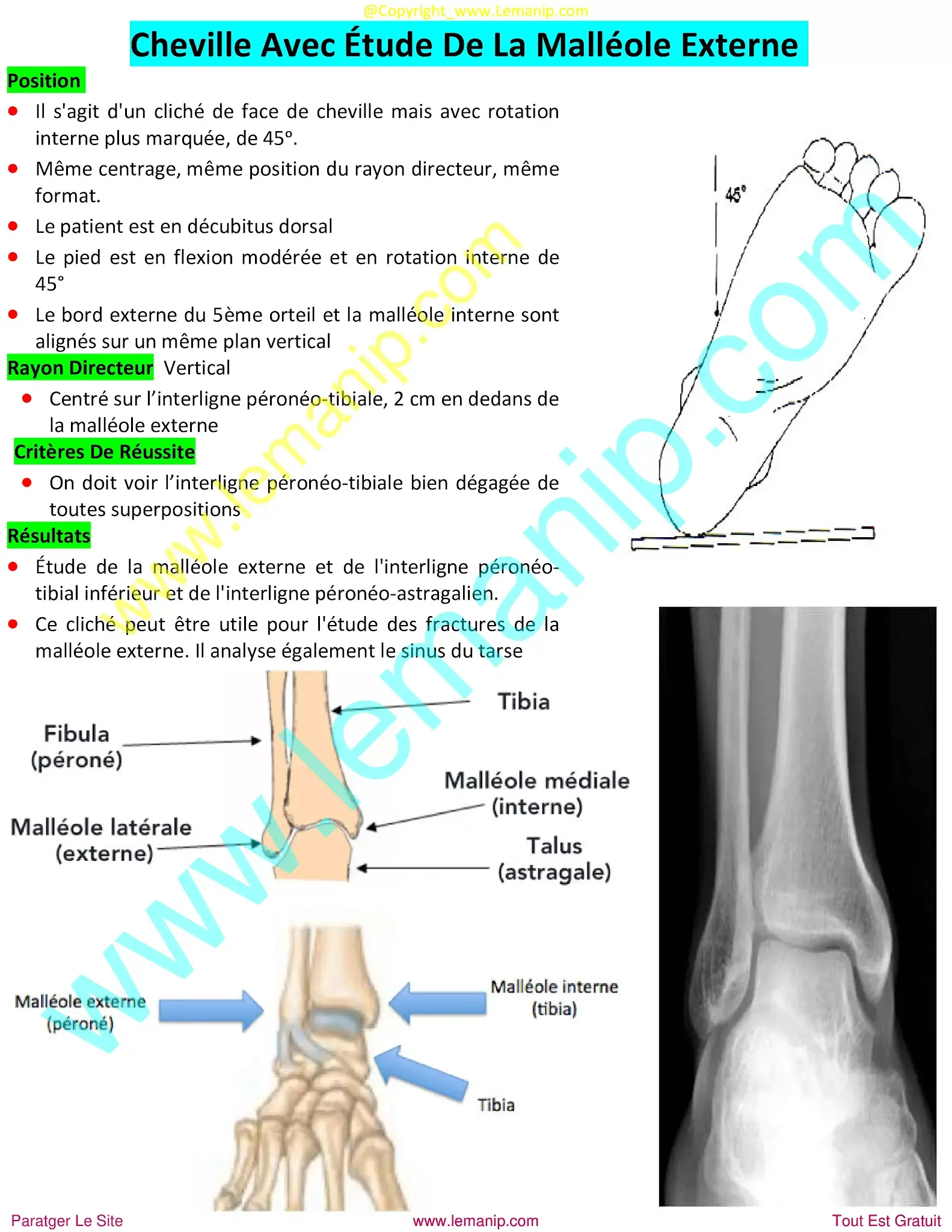 radiographie pb,radiographie bois de boulogne,r3r radiologie,radiographie st martin,radiographie saint martin,radiologie a domicile,radio medicale,pb radiologie,radio imagerie,radiologie belanger