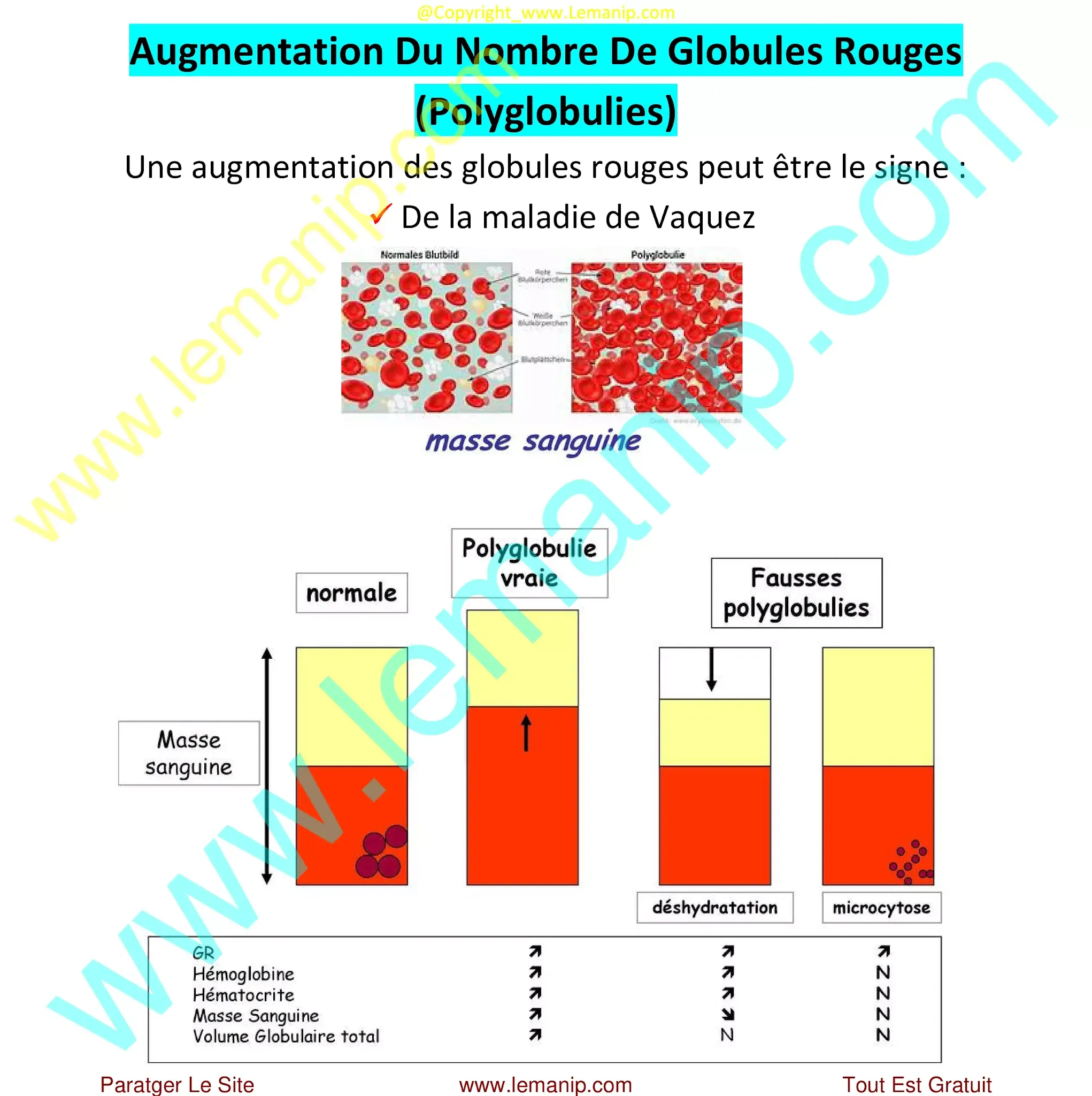 Polyglobulies : Augmentation Du Nombre De Globules Rouges