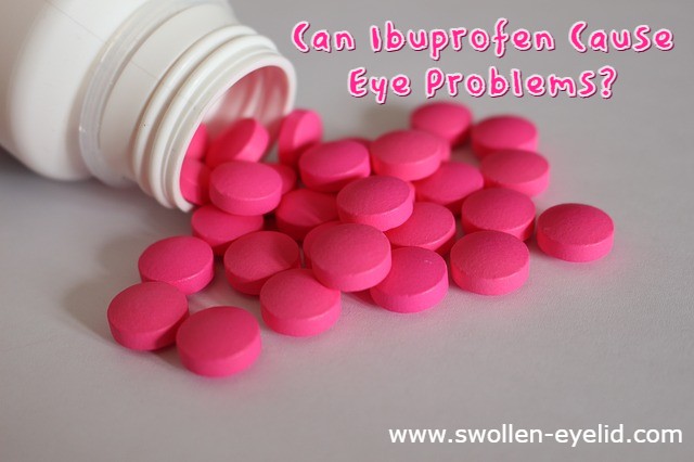 swollen-eyelids-after-ibuprofen