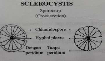Sclerocystis