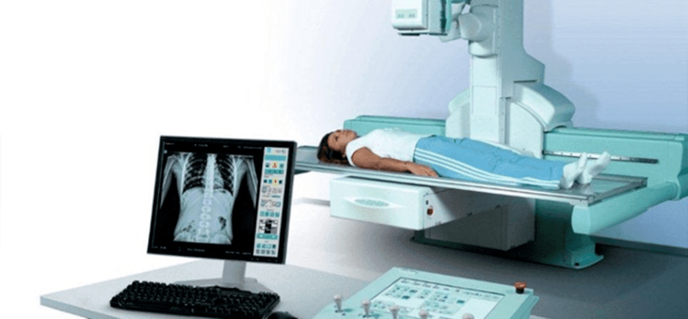 Digital Fluoroscopy System Market Size, Global Industry Challenges, Business Overview and Forecast