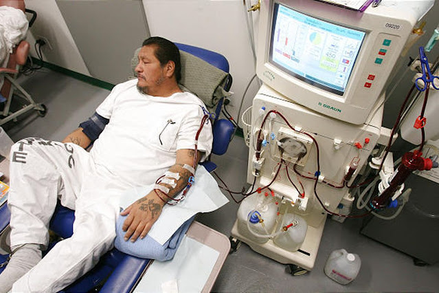 WHAT IS DIALYSIS ITS WORK AND TREATMENT