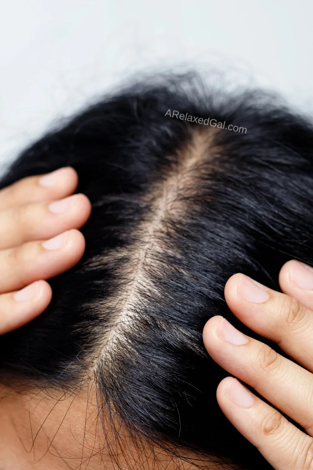 woman with hair parted showing her scalp