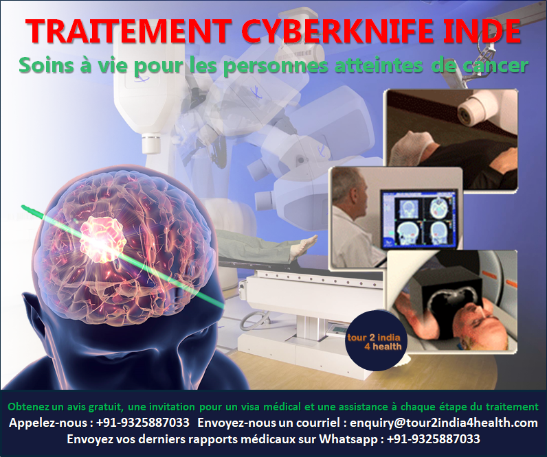 Meilleure radiochirurgie Cyberknife pour les tumeurs cérébrales en Inde