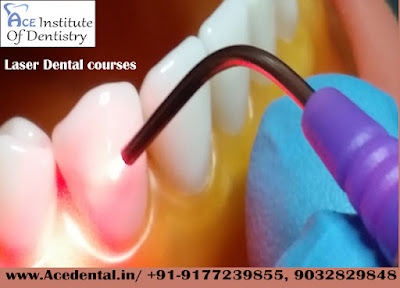 Laser Dental Courses in India