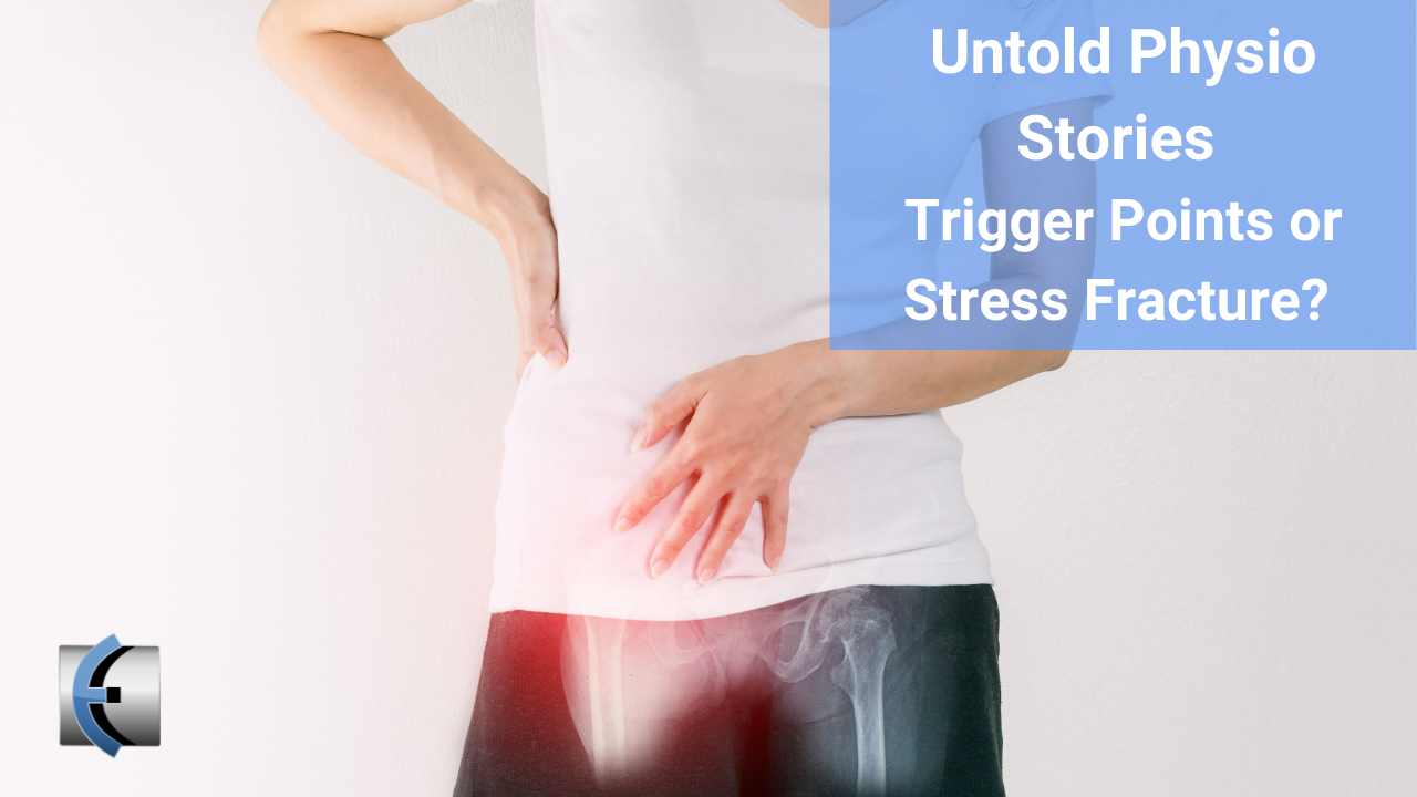 Untold Physio Stories - Trigger Points or Stress Fracture? - themanualtherapist.com