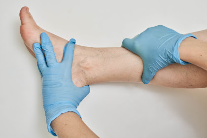 Experience A Renewed Sense Of Confidence With Varicose Vein Treatment