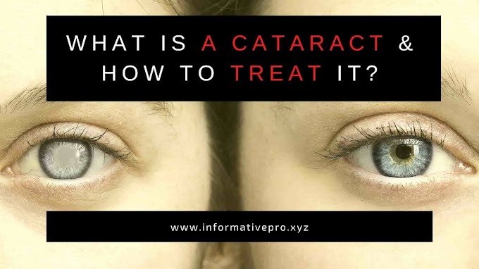 What is a cataract & how to treat it?