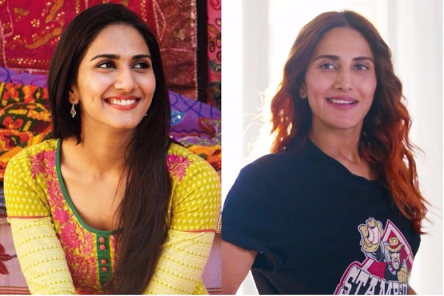 Vaani Kapoor before and after plastic surgery