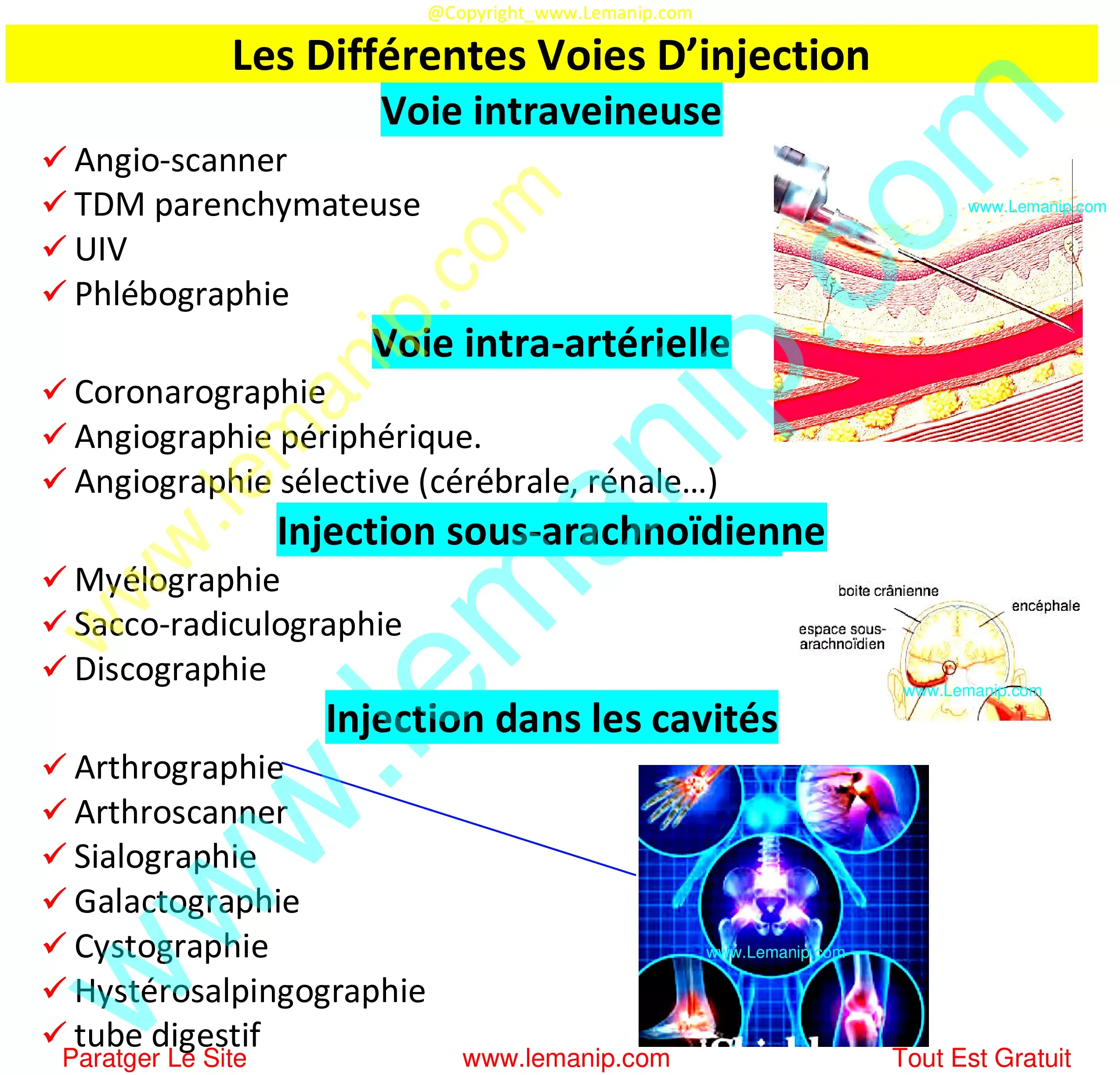 Voies injection produit de contraste