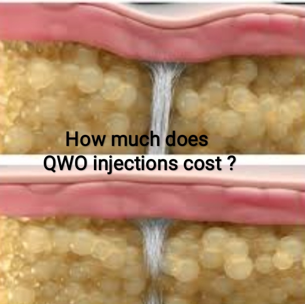 How much does QWO injections cost ?