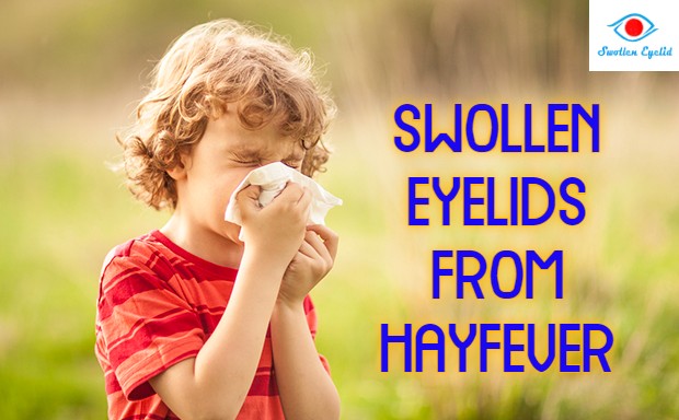 swollen-eyelids-from-hayfever