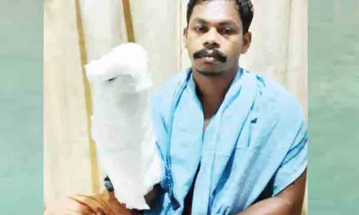 Forest staff’s Finger Amputated After Cracker Explodes, Thrissur, News, Local News, Injured, Hospital, Treatment, Kerala