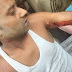 खेत में भूंसा भरने गए युवक पर दो तेंदुओं ने किया हमला, 5 मिनट संघर्ष में बची जान, घायल का सीएचसी में चल रहा इलाज 