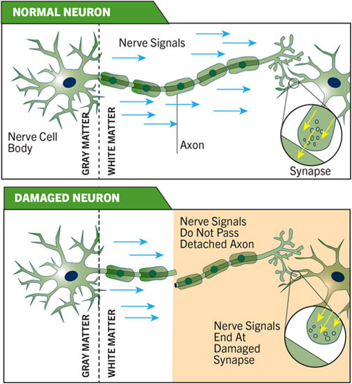 normal neurons