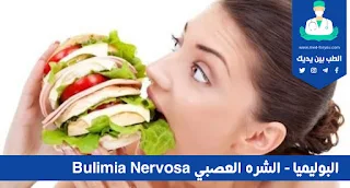 البوليميا - الشره العصبي Bulimia Nervosa