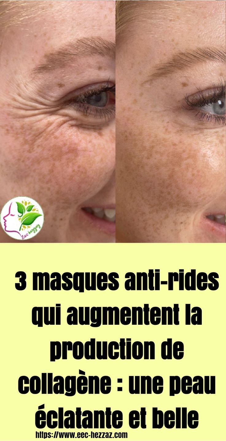 3 masques anti-rides qui augmentent la production de collagène : une peau éclatante et belle