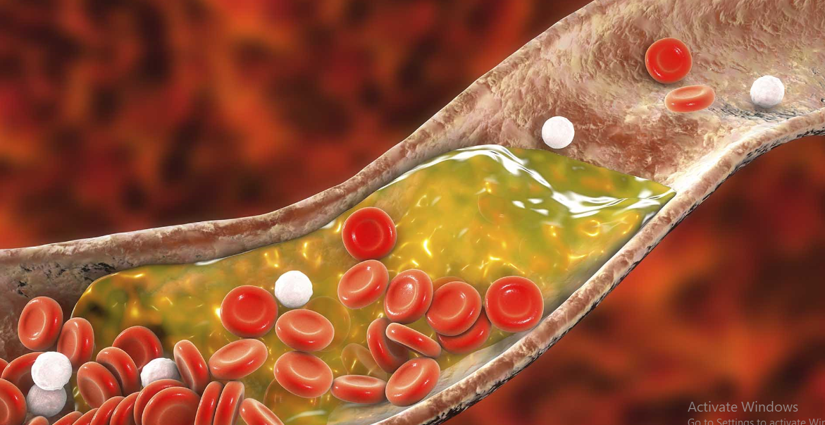 What Doctors Tell You About High Cholesterol