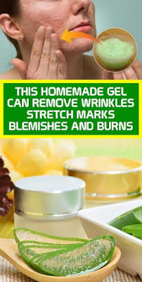 This Homemade Gel Can Remove Wrinkles, Stretch Marks, Blemishes And Burns!