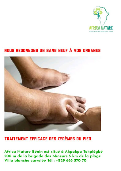 AFFRICA NATURE DISPOSE DE SOIN NATUREL ET EFFICACE CONTRE CE MAL