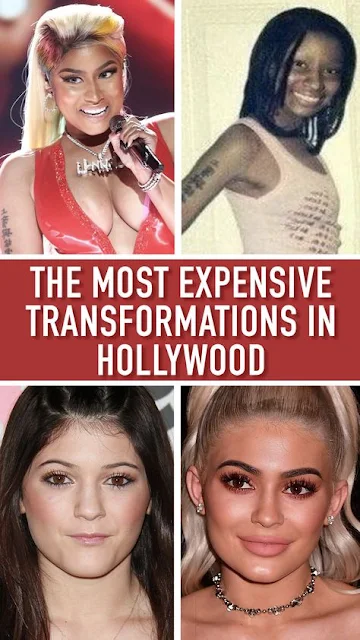 It Cost Them An Arm and A Leg – The Most Expensive Celeb Plastic Surgeries