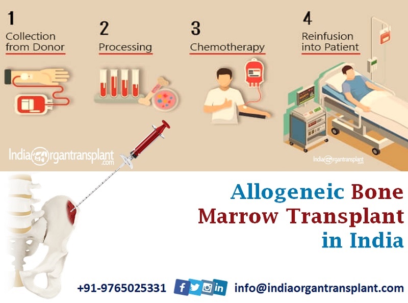 Bone Marrow Transplant in India