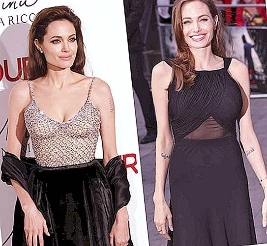 PLASTIC SURGERY BY ANGELINA JOLIE: PHOTOS BEFORE AND AFTER, RESULTS OF THE OPERATIONS