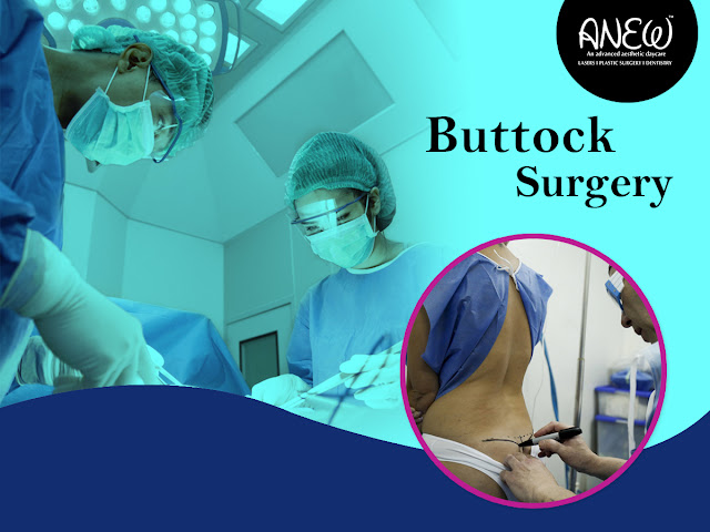 Buttock Surgery in Bangalore