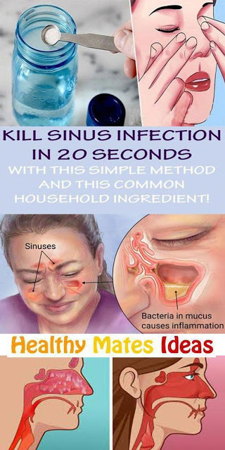 Kill Sinus Infection in 20 Seconds with This Simple Method and This Common Household Ingredient!
