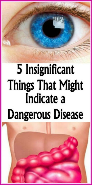 5 Insignificant Things That Might Indicate a Dangerous Disease
