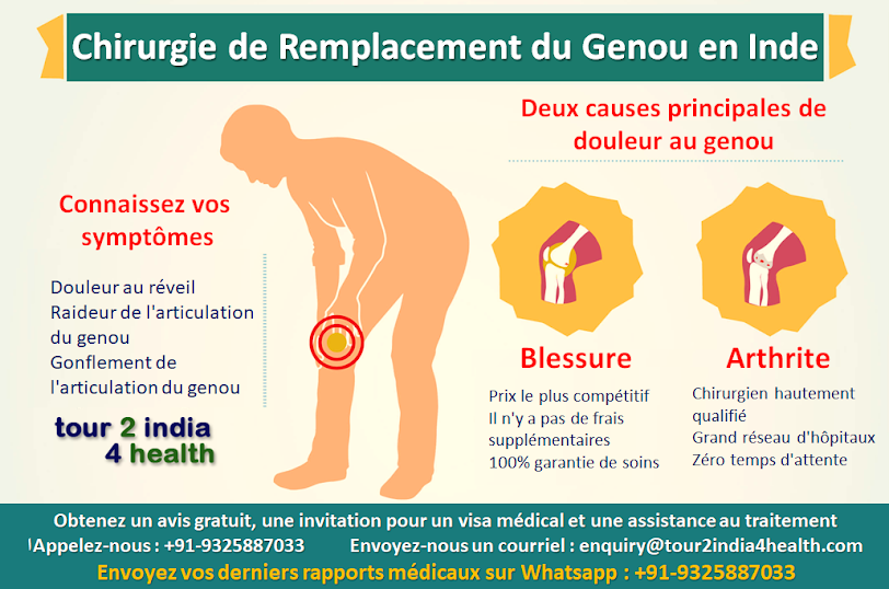 Meilleur pays pour la chirurgie de remplacement du genou au monde