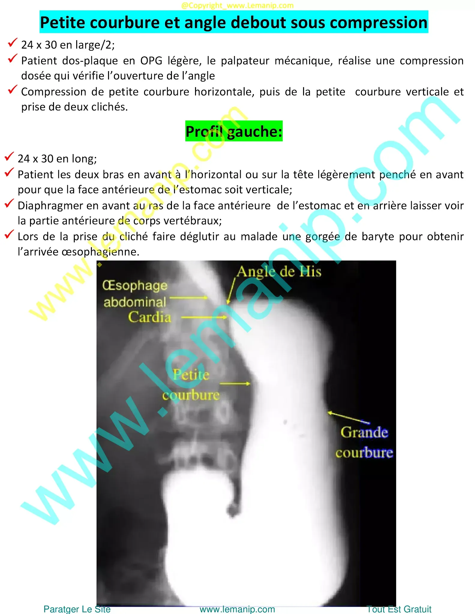 eosinophilic esophagitis symptoms in adults,ee esophagus,esophagitis endoscopy,the gastro group,dr rubin gastro,dr gold gastro,vanguard gastro,gj gastro,duodenal neuroendocrine tumor,esophageal esophagitis