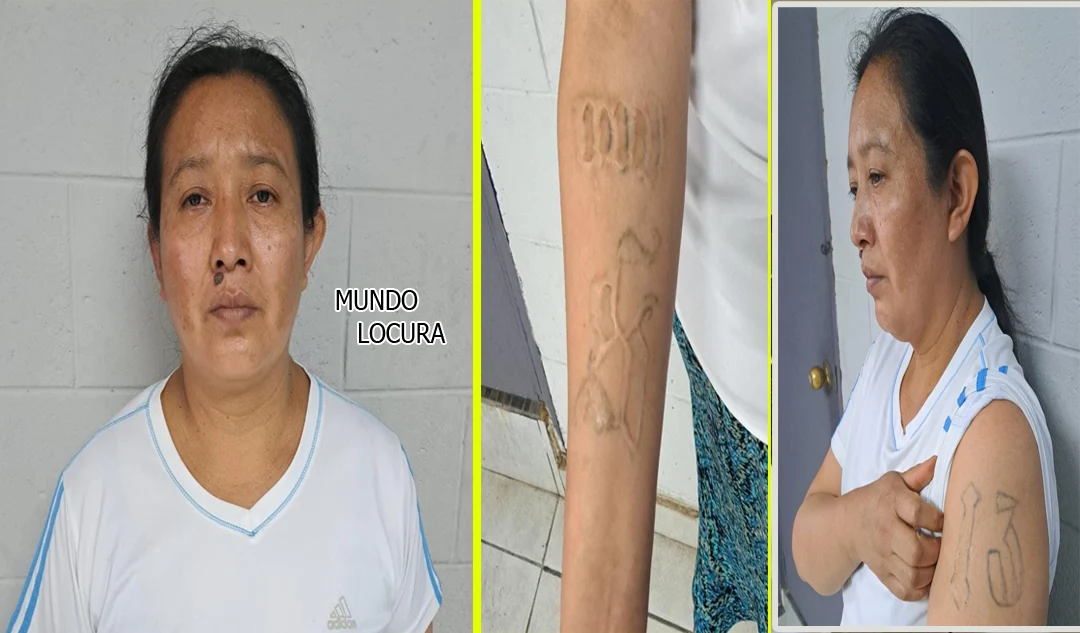 El Salvador: Capturan a pandillera que se quemó el brazo para ocultar su pertenencia a la MS13