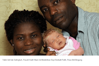 Pasutri Kulit Hitam Melahirkan Bayi Berkulit Putih, Suami Yakin Istri tak Selingkuh, Kini Terungkap