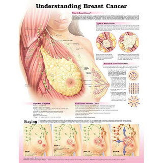 Breast cancer: Symptoms and causes