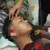 Bripda Ricardo Pasaribu, Anggota Polres Intan Jaya, Menjadi Korban Penganiayaan Brutal Di Papua