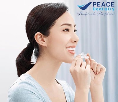 niềng răng invisalign là gì, quy trình niềng răng invisalign, Nha Khoa Peace,niềng răng invisalign, niềng răng trong suốt, niềng răng mắc cài sứ trong suốt,niềng răng mắc cài mặt lưỡi, niềng răng mắc cài kim loại, niềng răng không mắc cài Invisalign