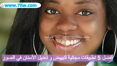 تطبيق تبييض و تعديل الأسنان في الصور | أفضل 5 تطبيقات ابتسامة هوليود سمايل مجانا