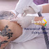 The Methods of Removal  Tattoos in Your Body - Part 1