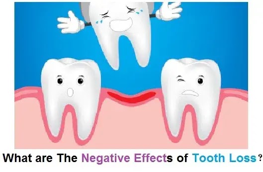 What are The Negative Effects of Tooth Loss?