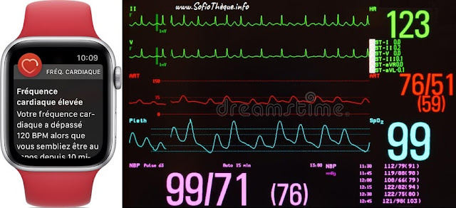 Causes of a fast heartbeat "palpitations"