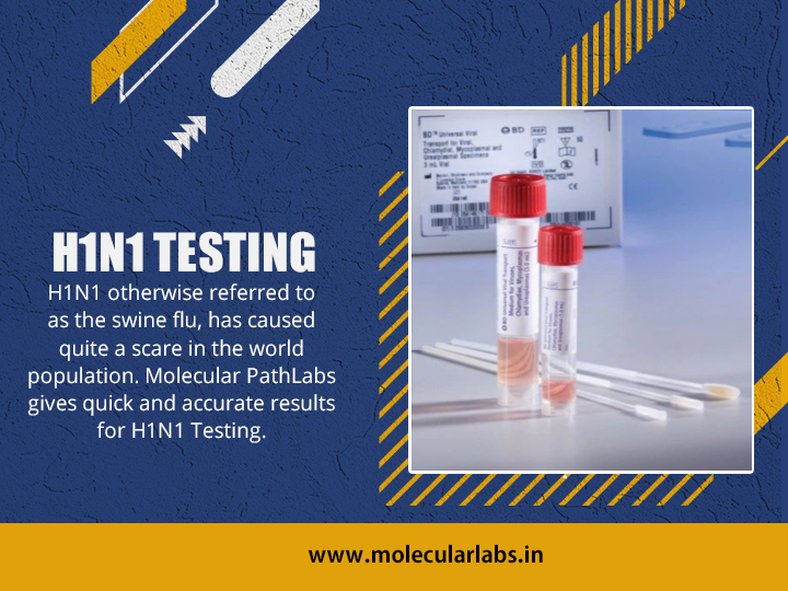 H1N1 TESTING