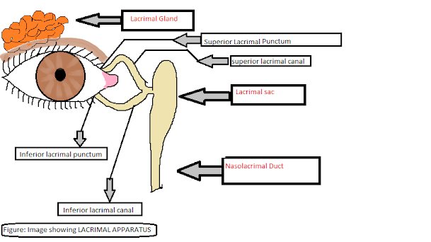 Dacryocystitis. Infection of tear or lacrimal sac