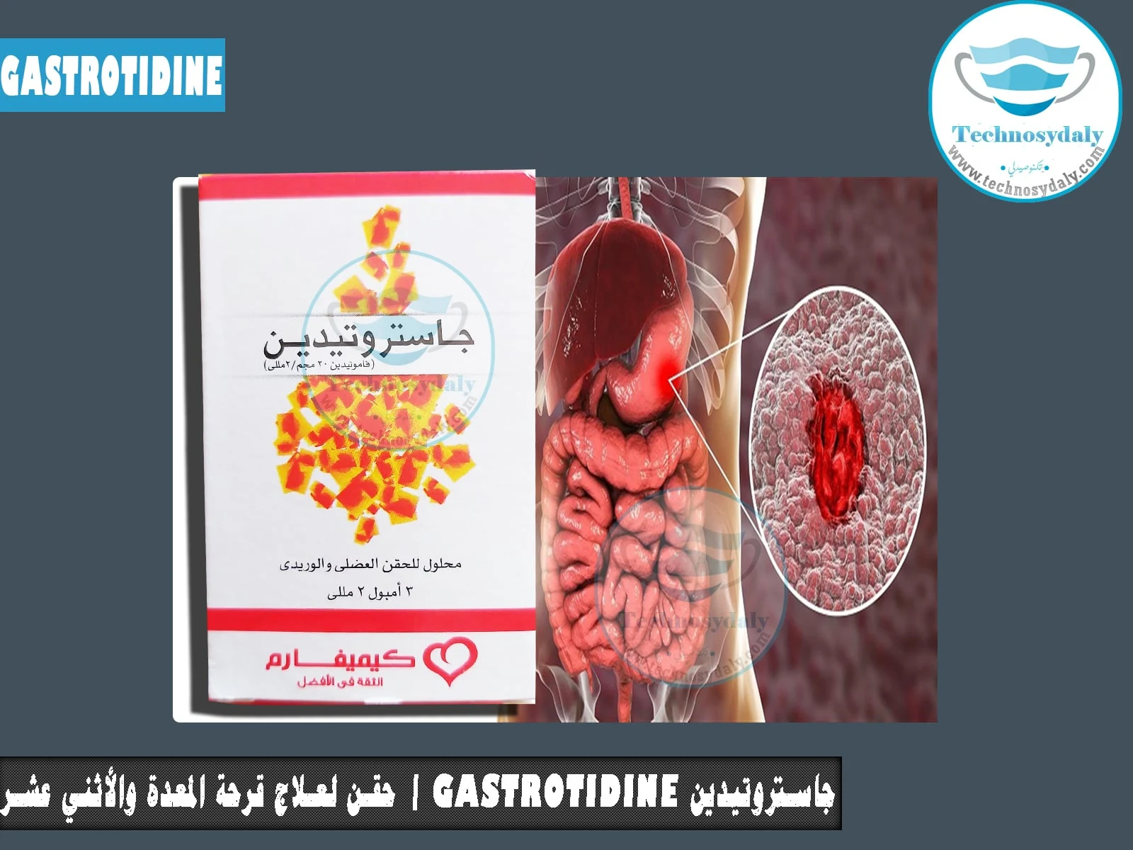 جاستروتيدين Gastrotidine  حقن لعلاج قرحة المعدة والأثني عشر