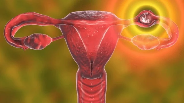 فهم أعراض الحمل خارج الرحم و كيفية التعرف عليها