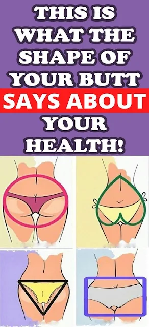 Butt Shape And Your Health !