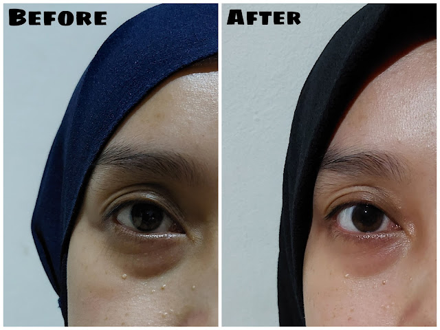 hasil pemakaian avoskin intensive nourishing eye cream